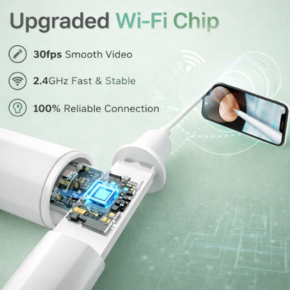 Inkmoths 1080P Wireless Otoscope Ear Wax Removal Camera